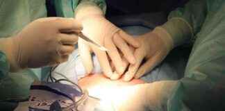 Father’s Kidney Became Hope for His 7-Year-Old Daughter – Sözcü Newspaper news-07102024-103859