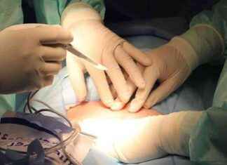 Father’s Kidney Became Hope for His 7-Year-Old Daughter – Sözcü Newspaper news-07102024-103859